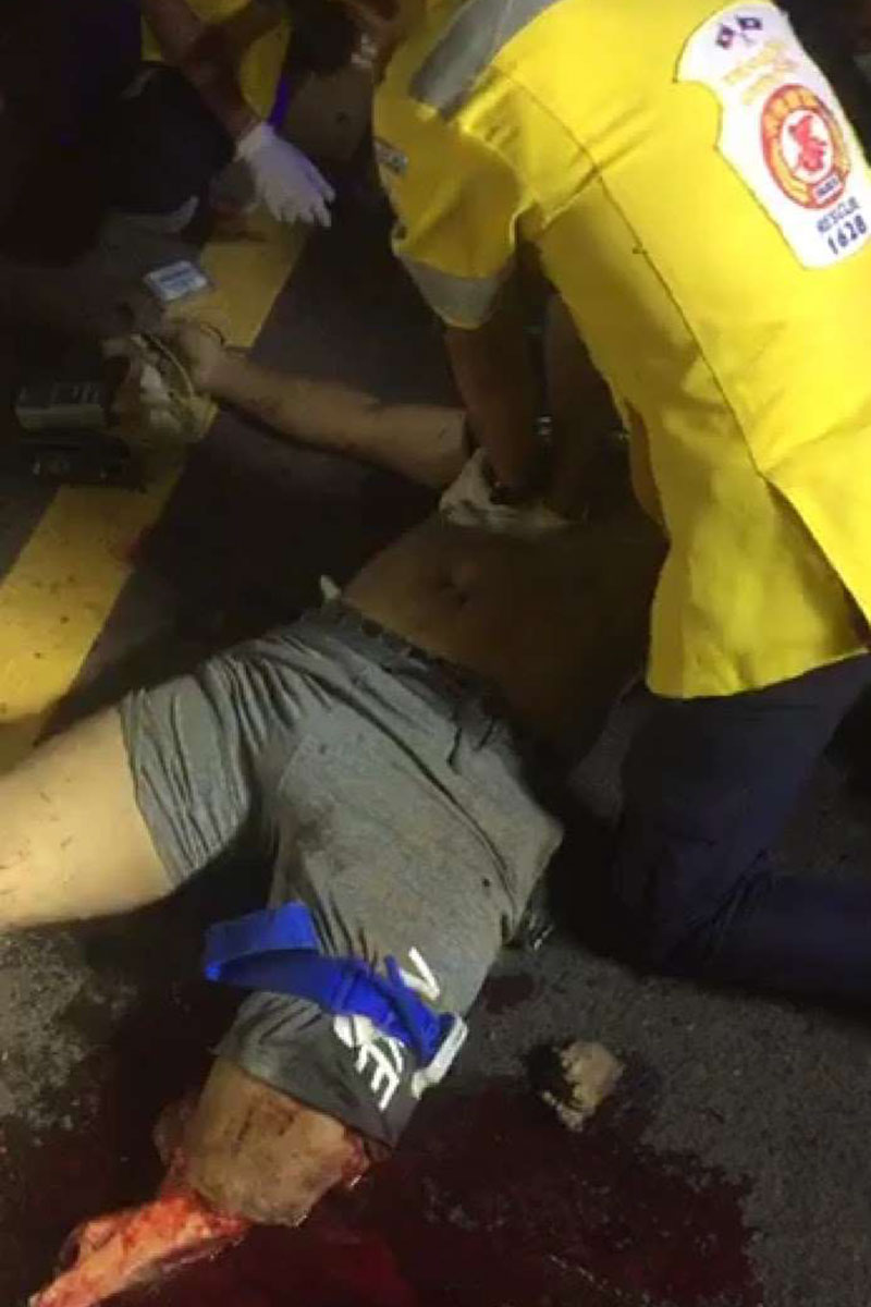 ລົດກະບະຕຳກັບລົດຈັກ ຢູ່ເສັ້ນທາງດ່ວນ ເຂດບ້ານຫົວຂົວ-ນາຊອນເຮັດໃຫ້ມີຜູ້ເສຍຊີວິດຄາທີ່ 1 ຄົນ